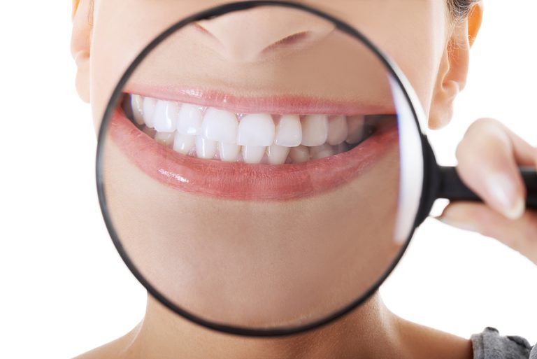 What to Expect on a Routine Dental Exam