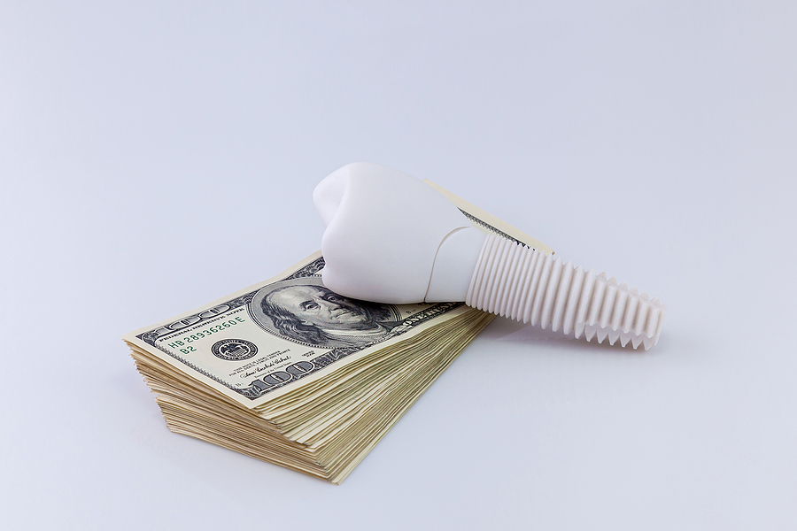 Dental Implants in Yuma  Why You Should Consider the Investment