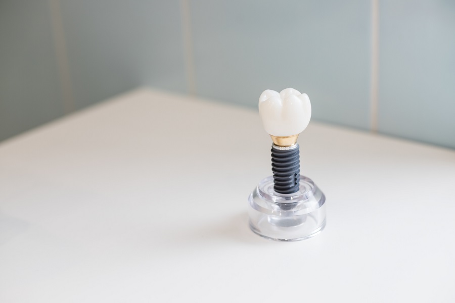 Discover the Benefits of Dental Implants