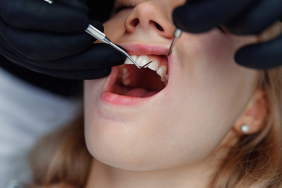 Effective Solutions for Periodontal Disease Treatment in Yuma, AZ