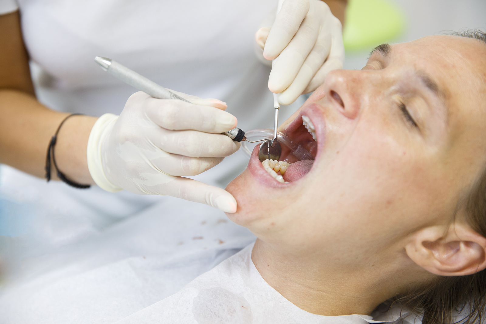 What to Expect During a Tooth Extraction: A Step-by-Step Guide