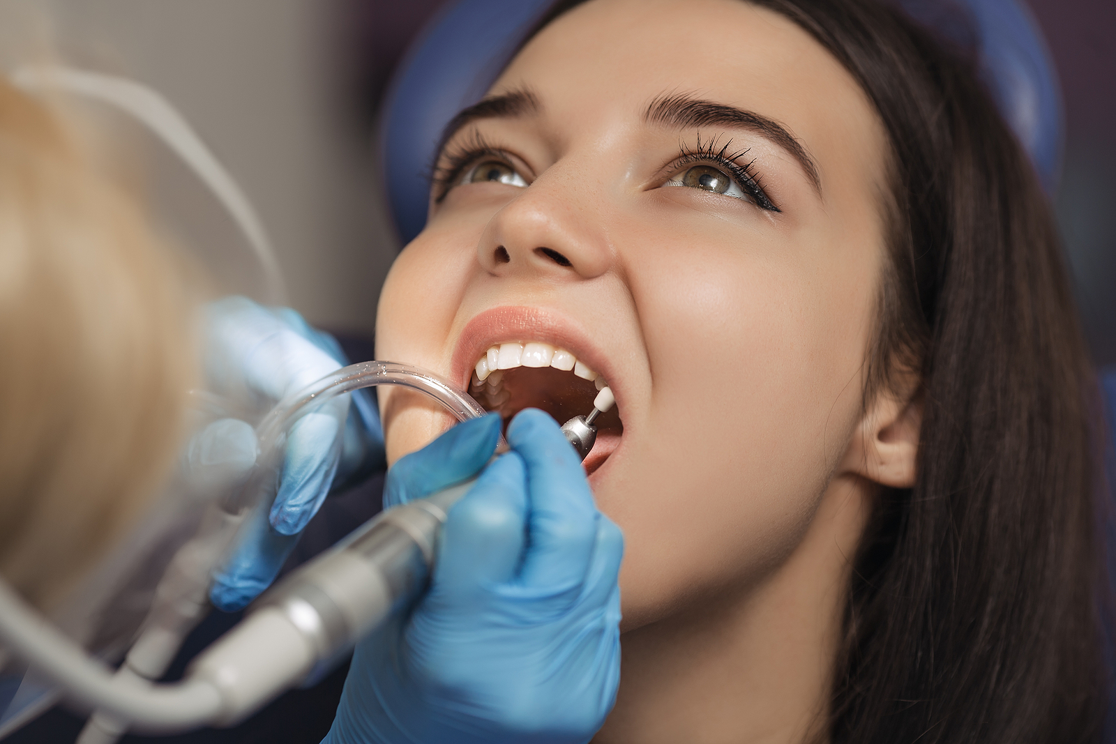 How to Speed Up Healing After a Tooth Extraction: Expert Advice